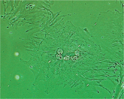 Figure 5. Osteoclast-like multinucleate cells were found in the cell population from the cambium layer (400 ×).