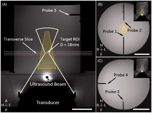 Figure 1. MR planning images in the phantom study, where the motion platform was used to simulate the breathing artifacts during MR temperature mapping. Four optical sensors were inserted in the phantom for temperature monitoring. Bar = 5 cm.