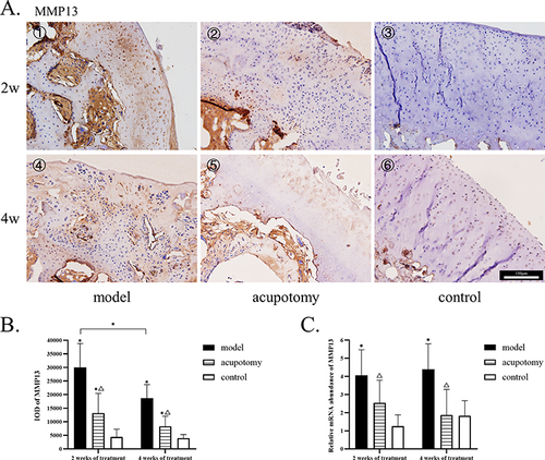 Figure 6 (A) 1–6: The immunohistochemistry staining of MMP 13; MMP 13 staining of the model group, acupotomy group, and control group depicted from more to less. All pictures use the scale in the image ⑥. (B) Quantitative analysis of the IOD of MMP 13. (C) The mRNA levels of MMP 13. Compared with the control group during the same time period, *P is < 0.05; Compared with the model group during the same time period, ΔP is < 0.05.