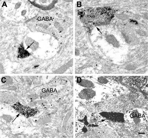 Figure 8 Electron micrographs of BDA-labeled corticogeniculate terminals in the LGN.