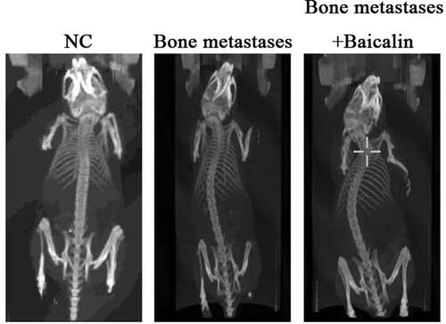 Figure 1 Baicalin recovered the bone resorption in the Bone metastases cancer. CT was used to detect BMD in SD rats of the NC group, the Bone metastases group and the Bone metastases + Baicalin group. The changes of BMD were calculated by SPSS software.