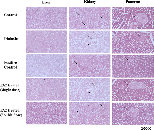 Figure 6 Histopathological studies of synthetic compounds (FA2) on alloxan-induced diabetic mice. All groups were kept in hygienic polypropylene cells and temperature-controlled animal house for 21 days. These micrographs were taken at 100X resolution via a compound microscope. The glomerulus and Langerhans islets were shown via arrow signs in kidney and pancreas micrographs, respectively.