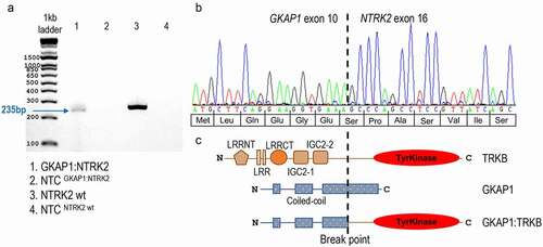 Figure 3. Sanger sequencing of the GKAP1-NTRK2 fusion transcript. (a) Picture of agarose gel with 1kb ladder showing the GKAP1-NTRK2 fusion gene fragment of 235 bp from the nested PCR (lane 1), the NTRK2 wt fragment of 251bp (lane 3), and non-template controls (NTC) for each PCR-reaction (lane 2 and 4). (b) Sanger sequence showing the fusion junction between GKAP1 exon 10 at position c.904 (NM_025211.3) and NTRK2 exon 16 at position c.1445 (NM_006180.4). Nucleotides and translation into amino acids is shown underneath the electropherogram. The junction generates an in-frame fusion transcript with a new serine amino acid at the breakpoint. (c) Illustration of the putative breakpoints in TRKB and GKAP1 proteins. The native TRKB protein (NP_006171.2, 838 amino acids (aa)) consists of 5 domains and 2 repeats; LRRNT (aa 32–61), LRR1 repeat (aa 92–113), LRR2 repeat (aa 116–137), LRRCT (148–196), Ig-like C2-type 1 (aa 197–282), Ig-like C2-type 2 (aa 295–365), and a tyrosine kinase (TyrKinase) domain (aa 538–807) in the C-terminal end (top illustration). The native GKAP1 protein (NP_079487.2, 366 aa) consists of three coiled-coil domains (aa 47–77, 128–160, and 243–353; middle illustration). The breakpoint position in GKAP1 (aa 301) and in TRKB (aa 357) is marked by a vertical dotted line. The GKAP1:TRKB putative fusion protein is 658 aa long and contains two coiled-coil domains from GKAP1 joined to the TyrKinase domain of NTRK2 (bottom illustration). Domains and positions are according to NextProt (http://www.nextprot.org)
