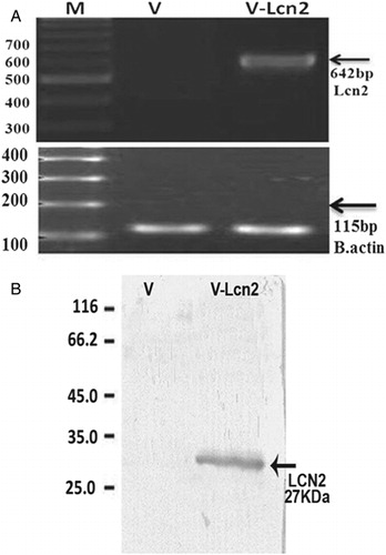 Figure 2. Expression of recombinant Lcn2 by HEK293T cells: (A) RT-PCR: RT-PCR analysis showed high levels of Lcn2 expression by the stable HEK293T cells. No detectable amount of expression was observed in non-transfected HEK293T. The HEK293T-Lcn2 showed a 642-bp fragment (lane V-Lcn2), whereas no expression was detected in HEK293T transfected with the non-recombinant pcDNA3.1 plasmid (HEK293T-V) (lane V). M, 100 bp DNA marker. (lower image) Expression of β-actin was used for normalization. M, 100 bp DNA marker. (B) Western blot analysis of Lcn2 after purification. Control HEK293T-V (lane V) revealed no detectable expression of Lcn2 protein compared to the HEK293T-Lcn2 (lane V-Lcn2).
