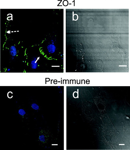 Figure 8 Immunofluorescence of ZO-1 in adherent human dermal fibroblast cultures. Fibroblasts were fixed, blocked, and then stained for ZO-1 using mouse monoclonal antibody, followed by goat anti-mouse Alexa-488. Nuclei (blue) were highlighted by TOTO-3 in all panels. A, ZO-1 (green) staining. (→) ZO-1 at zipper cell-cell contacts. (broken →) ZO-1 at punctate cell–cell contacts. B, corresponding DIC image of panel A. C, isotype antibody control staining (green). D, corresponding DIC image of panel C. Images were analyzed using Zeiss LSM Image Examiner™ software. All panels were collected and displayed utilizing identical signal detection/gain settings. Scale bars, 10 μm.