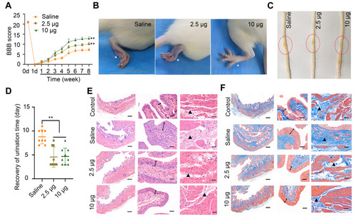 Figure 4 Assessment of locomotor functional recovery following traumatic spinal cord injury (TSCI). (A) BBB scores of rats with TSCI treated with saline, 2.5 μg Se-CQDs, or 10 μg Se-CQDs. ** P < 0.01, in comparison with the saline group. (B) Typical images of the foot in rats with TSCI after treatment with saline, 2.5 μg Se-CQDs, or 10 μg Se-CQDs. The asterisk * indicates the hindlimb walking patterns. (C) Typical images of spinal cords collected from rats in the saline, 2.5 μg Se-CQDs, or 10 μg Se-CQDs treated groups at 8 weeks post-injury. The red circles indicate the lesion sites. (D) Recovery of the urination time of rats with TSCI after treatment with saline, 2.5 μg Se-CQDs, or 10 μg Se-CQDs ** P < 0.01, when + Se-CQDs group was compared with saline group. (E) H&E staining of bladders shown at 2× (left) and 20× magniﬁcation (right), and the followed two images show the magniﬁed views of the ﬁelds marked by the blue squares, arrows and triangles indicated the pathological characteristics. (F) Masson staining of bladders shown at 2× (left) and 20× magniﬁcation (right). In the Figure 4E and 4F, the two images on the right are the magniﬁed views of the ﬁelds marked by the blue squares in the leftmost image; arrows and triangles indicated the hyperplasia and fibrosis characteristics of bladder, respectively. The scale bars are 500 μm and 50 μm for the images obtained at 2× and 20× magniﬁcation, respectively.