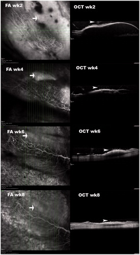 Figure 2. OCT of subretinally injected Matrigel at the medullary ray. These simultaneous FA and OCT images at different time points were acquired 15–20 minutes after intravenous injection of sodium fluorescein. OCT demonstrated that the retinal detachments and subretinal fluid diminished over time. The sodium fluorescein pooling into the subretinal fluid was recognizable (arrow) and decreased in area and intensity over time. It did not completely disappear by week 8. The vitreous opacity or granules (arrowhead) immediately above the detached retina were recognizable in OCT frames, indicating inflammation.