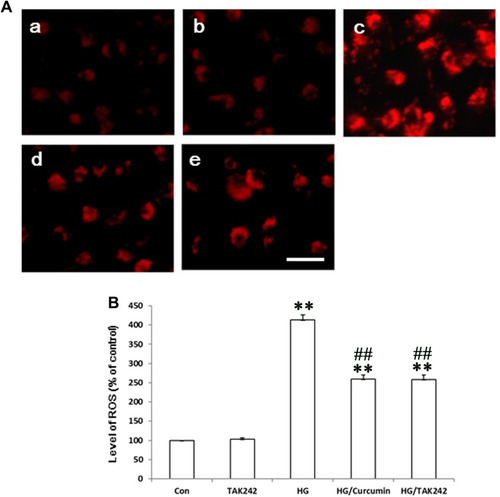 Figure 7 Curcumin via Inhibition of TLR4/NF-κB Signaling reversed the HG-induced ROS Production in NRK-52E Cells. TAK242 5 μM (the inhibitor of TLR4) was added to the medium of NRK-52E cells for 2 h. The cells were subsequently exposed to HG for 48 h after the treatment with Curcumin 20 μM for 24 h. (A) The HG-induced intracellular ROS levels in NRK-52E cells were measured with DCF-DA staining. (a. control group; b. TAK242 5 μM group; c. HG 30 mM group; d. HG/Curcumin group; e. HG/TAK242 group. Magnification was ×400, Scale bars=30 μm). (B) Data were expressed as means ± SEM (**P < 0.001 vs Control group, ##P < 0.001 vs HG).
