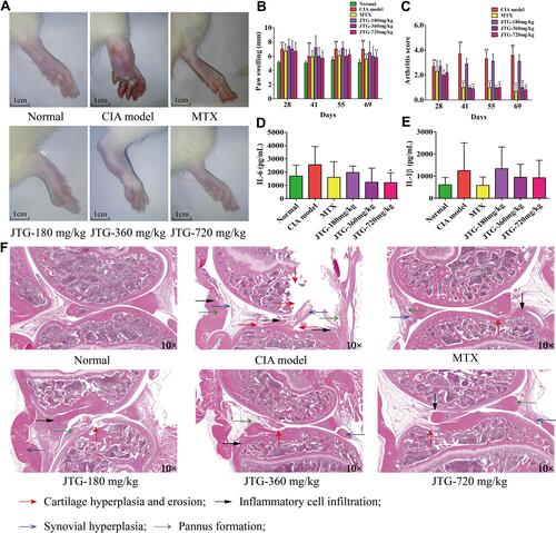 Figure 5 Effects of JTG on rheumatoid arthritis in CIA rats. (A) Pathological phenotype changes in CIA rats; (B) Paw swelling; (C) Arthritis score; (D) Serum IL-6 level; (E) Serum IL-1β level; (F) Histopathological changes of joints in CIA rats treated with JTG. The red arrow indicates cartilage hyperplasia and erosion; the black arrow indicates inflammatory cell infiltration; the blue arrow indicates the synovial hyperplasia; the green arrow indicates pannus formation. Data were expressed as the mean ± SD (n=10), ##P < 0.01 vs normal group; *P < 0.05, **P < 0.01 vs CIA model group.