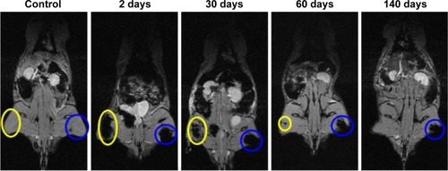 Figure 4 Typical series of MRI images of a Wistar rat treated with 50 mg/kg of cat-USPIOs as a function of time from zero up to 140 days after IV injection, confirming the magnetically induced accumulation of cat-USPIOs in the left thigh by a magnet placed in the local during 2 hours (blue circle).Note: The negative contrast shown in the right thigh (yellow circle) is due to the subsequent intramuscular administration of 15 mg/kg of cat-USPIOs.Abbreviations: cat-USPIOs, cationic ultrasmall superparamagnetic iron oxide nanoparticles; MRI, magnetic resonance imaging; IV, intravenous.