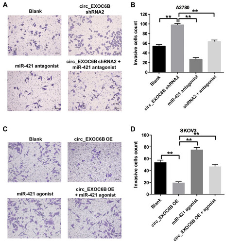 Figure 4 Overexpression of circEXOC6B inhibited the invasion of ovarian cancer cells. (A, B) A2780 cells were treated with circEXOC6B-shRNA2 or/and miR-421 antagonist for 24 h. The invasion ability of A2780 cells was measured using transwell invasion assay. (C, D) SKOV3 cells were treated with lenti-circEXOC6B or/and miR-421 agonist for 24 h. The invasion ability of SKOV3 cells was measured using transwell invasion assay. **P < 0.01.