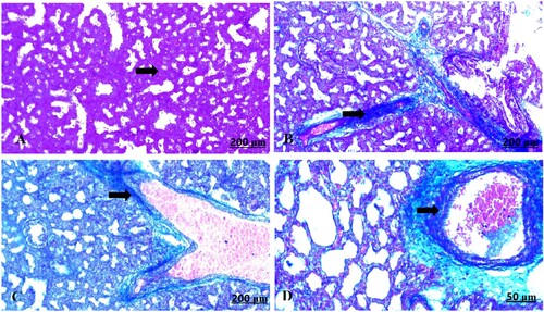 Figure 10. (A–D) Light photomicrograph of sections from foetal lung of control (A) and GAE received group (B–D) stained with Masson’s Trichrome: light photomicrograph of (A) shows less distinguished collagen fibres. Photomicrograph of (B–D) shows deeply stained collagen fibres.