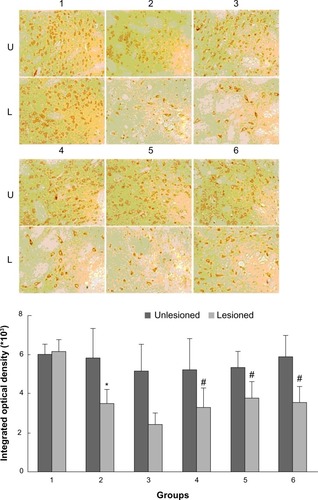 Figure 3 Effect of Tianqi antitremor granules on levels of GRK6 in dyskinetic rats.