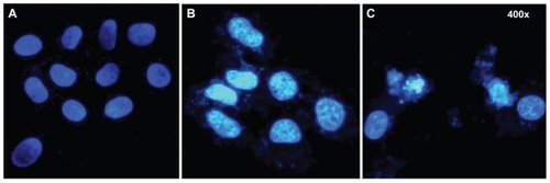 Figure 4 Fluorescence micrographs of HepG2 cells treated by SNP20 at 160 μg/mL with (A) vehicle, (B) at 24 hours, and (C) at 48 hours (400× magnification). Cells were stained with DAPI to visualize nuclear morphology. Note that vehicle-treated HepG2 cells contained round nuclei with homogeneous chromatin. The cells treated with SNP20 showed chromatin condensation, reduction of nuclear size, and nuclear fragmentation.Abbreviation: SNP20, size 20 nm silica nanoparticles.