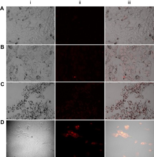 Figure 9 Confocal microscopic images of Mn:ZnS-treated MCF-7 cells (A), FACS-Mn:ZnS-treated MCF-7 cells (B), MDA-MB-231 cells (C), and MCF-10 cells (D), respectively.Note: From each zone, (i) represents the normal transmission image, (ii) represents the fluorescence image, and (iii) represents the combination/overlaying of both transmission and fluorescence images of the corresponding cells.Abbreviations: FACS-Mn:ZnS, folic acid–chitosan stabilized Mn2+-doped ZnS; ZnS, zinc sulfate.