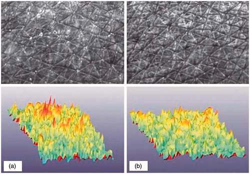 Figure 3. Skin surface evaluation. Surface of the skin of a volunteer from group 2 (formula B) before (a) and after 12 weeks of treatment (b); CCD picture and 3-D computerized image. Skin surface was evaluated by image analysis (SELS).