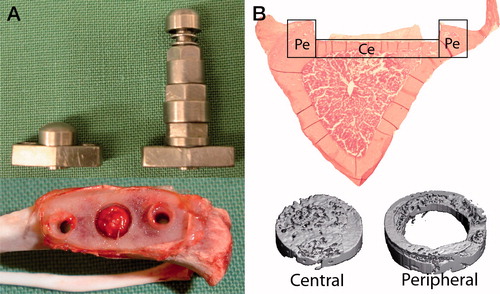 Figure 1. Overview of implants for instability-induced osteolysis and the studied rat tibia.A. The central screw (S) and the pressure piston (P) that are placed in the titanium plate and implanted in the proximal tibia. Retrieved proximal tibia demonstrating the fibrous tissue that forms beneath the piston.B. Histological section with the central (Ce) cortical bone underneath the pressure piston and the peripheral (Pe) cortical bone at the periphery. MicroCT images illustrating the central and peripheral bone volumes.