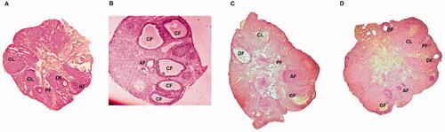 Figure 2. Cross sections of ovaries of rats of PCOS, control, metformin and Apigenin treated groups. (A) Cross section of ovarian tissue of control rats showing ovarian follicles along with primary follicles. (B) Ovarian tissues of PCOS rats showing various follicles. (C) Ovaries of MTF treated rats. (D) Ovaries of Apigenin treated rats.