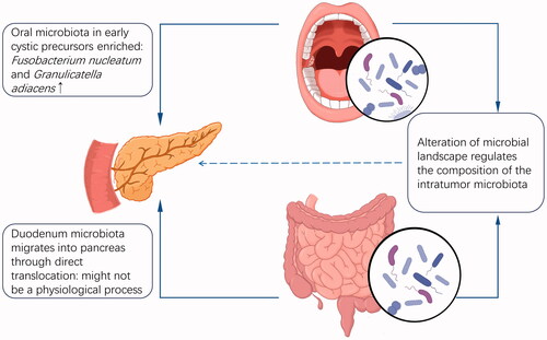 Figure 2. Colonization of the PDAC intratumor microbiota. Oral pathogens were found to be enriched in pancreatic cystic precursors; experiments demonstrated that microbiota within pancreatic tissues arise from retrograde migration from the duodenum via the pancreatic duct which opens in the duodenal papilla, but this translocation may not be a physiological process; translocation of duodenal microbiota cannot explain the origin of approximately 70% microbiota in PDAC.