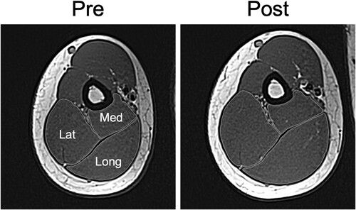 Figure 2. Example images of the right arm MRIs at ∼50% of the whole length of the triceps brachii taken at Pre (A) and Post (B). Anatomical cross-sectional areas of the Long, Lat, and Med heads of the triceps brachii are drawn. Lat = lateral; Long = long; Med = medial; Post = post-training; Pre = pre-training.