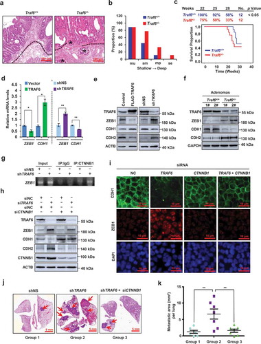 Figure 1. Reduced expression of TRAF6 causes local tumor invasion phenotypes in Traf6+/- mice, and induces ZEB1 expression and EMT via CTNNB1. (a,b) Representative H&E sections of intestinal tumors (a) and histopathological scoring of the invasive depth of colorectal cancer glands (b) in Traf6+/+ (n = 9) and Traf6+/- (n = 9) mice. Dotted lines in a, muscularis mucosae. Asterisk in a, colorectal cancer glands invading the submucosa. Mu, intramucosal; sm, submucosa; mp, muscularis propria; and se, serosa. (c) Kaplan-Meier survival curve analysis of Traf6+/+ (n = 12) and Traf6+/- (n = 12) mice in the AOM/DSS-induced colon cancer model. (d,e) qPCR (d) and western blotting (e) analysis of the indicated gene or protein expression in HCT116 cells transfected with TRAF6 plasmid or vector (left) and SW480 cells stably expressing control or TRAF6-specific shRNA (right). (f) Western blotting of the indicated proteins in intestinal tumors in Traf6+/+ and Traf6+/- mice. (g) Chromatin immunoprecipitation assays of CTNNB1’s ability to bind the ZEB1 promoter in SW480 cells stably expressing control or TRAF6-specific shRNA. The amplified ZEB1 promoter region (−325 to −101) contains CTNNB1-TCF4 binding sites at −161. (h) Western blotting to detect the indicated proteins in SW480 cells with indicated treatments.(i) Immunofluorescence staining of CDH1 (green) or ZEB1 (red) in SW480 cells with indicated treatments. Nuclei were stained with DAPI (blue). (j,k) Representative lung picture tissues are shown by HE staining (j), and the area of metastatic nodules in individual mice was calculated using Dmetrix software (k). Arrows indicate metastatic nodules (n = 7 for each group).