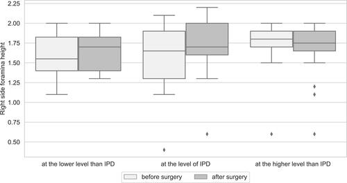 Figure 4 Median diameter of the right intervertebral foramen on the operated and adjacent segments.