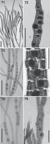 Figs 71–76. Tetrasporangia in the Polysiphonieae. Forming long straight series in Polysiphonia stricta (Fig. 71, Polysiphonia sensu stricto clade 1). Forming spiral series in Vetebrata lanosa (Fig. 72, Vertebrata clade), Polysiphonia sp. (Fig. 74, Streblocladia clade) and Neosiphonia harveyi (Fig. 76, Melanothamnus clade). Forming short straight series in P. denudata (Fig. 73, Carradoriella clade), and P. schneideri (Fig. 75, P. schneideri clade). Scale bars: Figs 71, 74 and 76, 200 µm; Figs 72, 73 and 75, 400 µm.