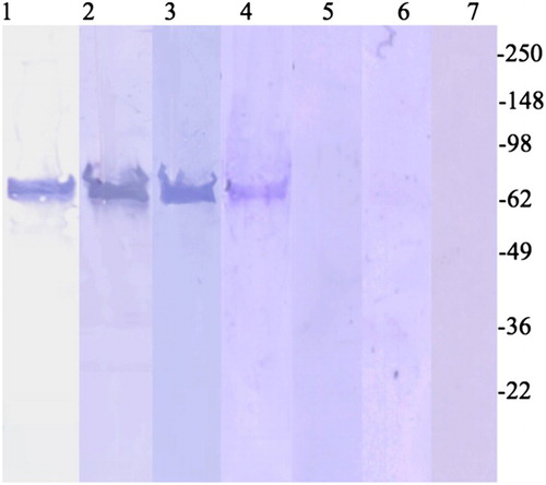 Figure 3. Cry1Ab-specific IgG Western blotting with sera from the highest ELISA responder of each population. Lane 1, Western Blot of Cry1Ab recognized by alkaline phosphatase-conjugated polyclonal rabbit anti-Cry1Ab IgG. Lanes 2–4, sera with the highest ODs (from Figure 2) from PNG, Kenya, and the USA, respectively. Lanes 5–7, sera negative for anti-Cry1Ab IgG (below cutoff threshold in Figure 2). Western blots were probed with sera diluted 1:200. Lane 1 is Cry1 probed with rabbit polyclonal and Cry1 antibodies.