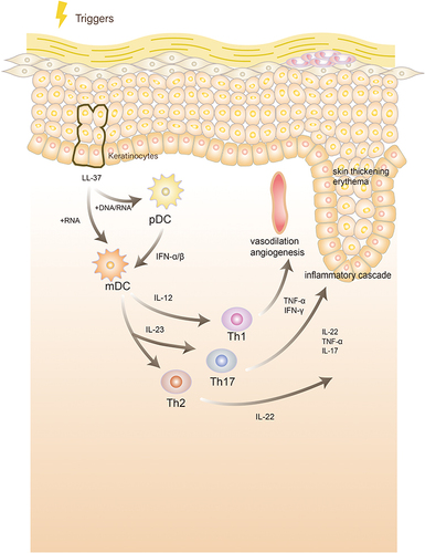 Figure 1 Pathogenesis of psoriasis:Under stimulation, keratinocytes release self-nucleotides and form antibacterial peptide LL-37-self-nucleotide complexes. These complexes stimulate plasmacytoid dendritic cells (DCs) to produce interferon (IFN)-α and IFN-β or directly stimulate myeloid DCs to mature and activate. Activated DCs produce interleukin (IL)-12 and IL-23 and activate and stimulate T helper (Th)1, Th17, and Th22 cells to produce cytokines such as IFN-γ, IL-22, tumor necrosis factor-α (TNF-α), and IL-17, causing an inflammatory cascade, leading to skin thickening, erythema, and vasodilation angiogenesis.