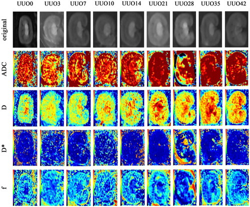 Figure 1. We selected the optimal slice from the original image to visualize the renal cortex and medulla for each quantitative parameter. IVIM diffusion weighted image obtained with b = 0 s/mm2 (the top row) and IVIM-derived parameters (ADC; D; D*; f) of contralateral kidney (the 2nd to 5th row). These IVIM parameter maps of the right kidney depicted rat study case prior to left kidney ligation and at 3, 7, 10, 14, 21, 28, 35, 42 days postligation. Over time, in the unobstructed side, the color gradient deepened between the cortex and medulla in ADC, D, and f parameter images, whereas the color change was less pronounced in the D* parameter image.