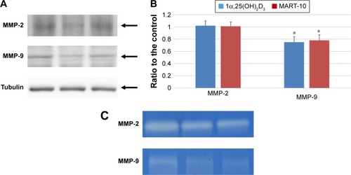 Figure 5 Effects of 1α,25(OH)2D3 and MART-10 on intracellular expression and extracellular activity of MMP-2 and MMP-9 in FaDu cells.