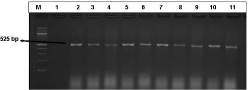 Figure 5 An illustrative gel electrophoresis image with the genetic expression of the aadA (525 bp) resistant gene among the aminoglycosides-resistant DEC and Salmonella isolates. Lane (M) molecular weight marker (100 bp DNA ladder, Thermo scientific), lane 1: negative control, lane 2 to 11: some of the representatives of the genetic expression of aadA (525 bp) from aminoglycoside-resistant DEC and Salmonella isolates.