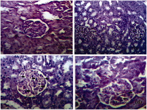 Figure 4. The expression of TGF-β1 in the glomeruli of kidney tiisue of different groups is represented. (a) Expression of TGF-β1 in glomeruli of control rat kidney. (b) Expression of TGF-β1 in diabetic rat kidney. (c) Expression of TGF-β1 in naringenin (5 mg/kg) treated diabetic rat kidney. (d) Expression of TGF-β1 in naringenin (10 mg/kg) treated diabetic rat kidney. Arrow represents the expression of TGF-β1 in glomeruli of kidney (H&E × 100; scale bars = 50 μm).