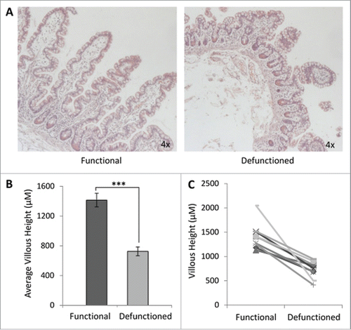 Figure 2. Histological analyses of function and defunctioned ileum. (A) Representative H&E stained sections, magnification 4x. (B) Average villous height ± SEM (n = 9, p = 0.0004) (C) Paired villous height.