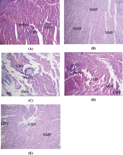Figure 4.  (A) Section of the heart of Dox-treated rats showing inflammatory changes. (B) Section of the heart of control rats showing normal cardiac muscle fibers with vesicular nuclei. (C) Section of the heart of FRSACE (250 mg kg−1) + Dox-treated rats showing congested blood vessels and inflammatory changes. (D) Section of the heart of Arjuna (100 mg kg−1) + Dox-treated rats showing inflammatory changes. (E) Section of the heart of FRSACE (500 mg kg−1) + Dox-treated rats showing normal cardiac muscle fibers and some congested blood vessels; NMF: normal cardiac muscle fibers, PNMI: perivascular mononuclear infiltrate, CBV: congested blood vessel.