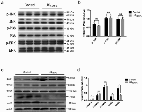 Figure 3. LIPUS increases HDAC1 expression and decreases histone 3 and histone 4 acetylation modification. (a) The phosphorylation levels of ERK, P38 and JNK were analyzed by western blotting. (b) Quantification of p-ERK, p-P38 and p-JNK normalized to their total proteins. (c) Nuclear protein levels of HDAC1, HDAC2, HDAC6, AcH3 and AcH4 were assessed by western blotting. (d) Quantification of HDAC1, HDAC2, HDAC6, AcH3 and AcH4 normalized to Lamin B. Relative protein levels were analyzed with independent t test. All values are expressed as the mean ± SEM of three independent trials. * P < 0.05.