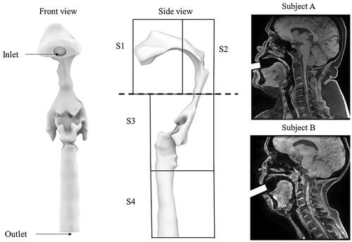 Figure 1. The upper airway model with labels from the front view and side view. Two typical sagittal images of the subjects are also presented in the figure. S1 represents the oral cavity, S2 represents a segment of the oral cavity and the oropharynx, section 3 represents a section of the oropharynx and laryngopharynx, and section 4 represents the trachea.