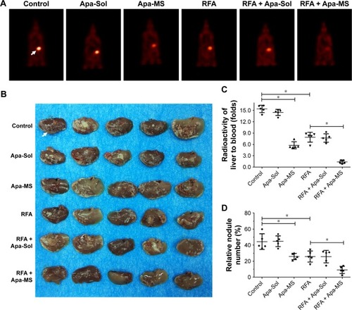 Figure 7 Single dose of Apa-MS but not Apa-Sol inhibited the in vivo growth of HCC cells and enhanced the effect of RFA on intrahepatic HCC model. Single cells from tumors of solvent control group, RFA group, Apa-Sol group, Apa-MS group, RFA + Apa-Sol group and RFA + Apa-MS group were harvested and injected into liver via hepatic portal vein. After 3–4 weeks, animals were examined using a PET/CT scanner. Quantitative results are shown as (A) PET images of whole animals, (B) photographs of liver with multifocal nodules of HCC, (C) radioactivity ratio of liver to blood and (D) relative nodule number. *P<0.05.