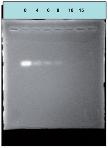 Figure 5 Agarose electrophoresis of small interfering RNA/polyethylenimine-polyethylene glycol complexes.