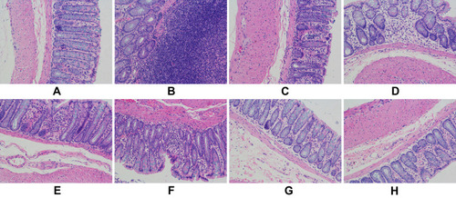 Figure 9 Pathological colon sections stained with H&E in each group (200 ×) (A) control group, (B) model group, (C) SASP group, (D) GPs group, (E) EPs group, (F) DPs low dose-group, (G) DPs medium-dose group, (H) DPs high-dose group.