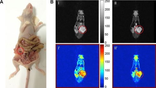 Figure 4 (A) Orthotopic ovarian mouse tumor (red circle is the tumor position). (B) In vivo T2-weighted magnetic resonance images of the xenograft tumor model before (left) and 24 hours after (right) injection of M-MSN_NC siRNA@PEI-PEG-KALA.Notes: Gray-scale images (top, I and II) and pseudocolor images (bottom, I’ and II’) are shown.Abbreviations: M-MSN, magnetic mesoporous silica nanoparticles; PEI, polyethylenimine; PEG, polyethylene glycol; KALA, a type of fusogenic peptide; NC siRNA, negative control small interfering RNA.