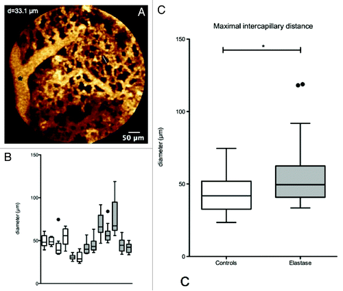 Figure 2. The subpleural capillary network observed with fiberd confocal fluorescence microscopy (FCFM) after IV injection of fluorescein. (A) The subpleural capillary network is easily recognized, and extra-alveolar vessels can be observed (*). (B) The intercapillary distance was measured on selected frames displaying typical capillary network. The ten maximal intercapillary distances were selected for the quantitative analysis, and are displayed as median ± interquartile range for each animal. Inter-individual variability, assessed by the inter-quartile range of the medians was [30–55] µm in the control group, and [42–66] µm in the elastase group. (C) The intercapillary distance was higher in the elastase-treated animals (median = 49.5µm [IQR (40.8 - 62.4)]) than in controls (median = 41.8µm [IQR (32.7 – 51.9)]) (p < 0.001, Mann-Whitney test).