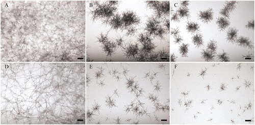 Figure 5. Antifungal activity of the crude enzyme. Conidia of Aspergillus flavus and Aspergillus niger were cultured with the crude enzyme in a 96-well microplate. Following incubation at 25 °C for 2 d, fungal growth was observed using a microscope. (A–C) A. flavus; (D–F) A. niger. (A,D) Positive control for fungal growth (no addition of the crude enzyme); (B,E) Inhibition of hyphal growth by addition of the crude enzymes of GJ-Sp1; (C,F) Inhibition of hyphal growth by addition of the crude enzymes of TOP-Co8. Scale bar = 100 μm.