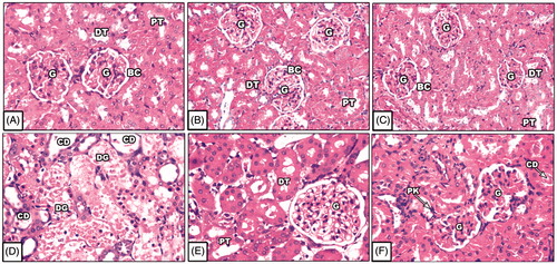 Figure 3. Representative photomicrographs of kidney by staining with hematoxylin and eosin of control and different treated rat groups. Notes: [A] Normal control untreated rats (normal glomerular architecture and normal proximal and distal convoluted tubules with cuboidal epithelial cells); [B] GSPE-treated rats; [C] FO-treated rats (normal glomerular architecture and normal proximal and distal convoluted tubules with cuboidal epithelial cells); [D] Cisplatin-intoxicated rats (tubular degeneration degenerative glomerulus, necrotic tubular cells, and cell debris); [E] Cisplatin-GSPE-treated rats and [F] Cisplatin-FO treated rats (amelioration the undesirable changes produced after cisplatin-intoxication).
