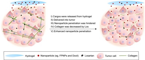 Figure 1 Schematic illustration of the enhanced intratumoral penetration of nanoparticles after peritumoral implantation of nanoparticle/Los-loaded hydrogel.Notes: In this work, FPNPs and Doxil (~100 nm) were employed as model nanoparticles. After peritumoral implantation of the nanoparticle/Los-loaded hydrogel, nanoparticles and Los could be released from the hydrogel and delivered into the tumor through blood vessels and lymphatic capillaries. The dense collagen networks in tumors greatly hinder the deep penetration of nanoparticles. Los effectively reduces collagen levels, thereby enhancing the intratumoral distribution of nanoparticles.Abbreviations: Doxil, liposomal doxorubicin; FPNPs, fluorescent polystyrene nanoparticles; Los, losartan.