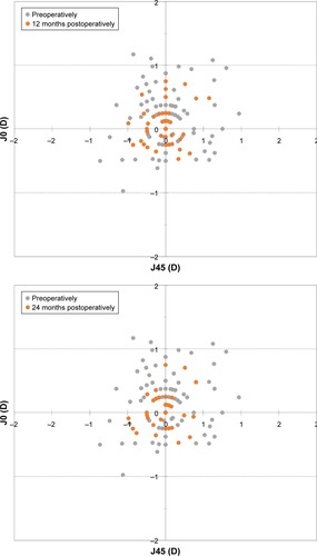 Figure 3 Preoperative and 12, 24, and 36 months postoperative astigmatic components of the power vector represented by the two-dimensional vector (J0, J45) (J0=Jackson cross-cylinder, axes at 180° and 90°; J45=Jackson cross-cylinder, axes at 45° and 135°).