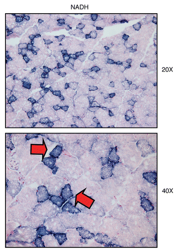 Figure 10 Visualizing mitochondrial complex I (NADH) activity in murine skeletal muscle tissue. Frozen sections of murine skeletal muscle (hind-limb/gastronemius) were subjected to NADH activity staining (blue color). Slides were then counter-stained with nuclear fast-red (pink color). Note that slow-twitch fibers (type I) are oxidative, are mitochondria-rich, and are NADH-positive (see red arrows). In contrast, fast-twitch fibers (type II) are glycolytic, are mitochondria-poor, and are NADH-negative. Two representative images are shown. Original magnification, 20x and 40x, as indicated.