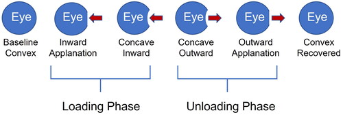 Figure 1. Schematic diagram of air puff loading of the cornea with red arrows indicating direction of movement. The initial phase is Baseline Convex prior to deformation. The Loading Phase includes deformation through Inward Applanation (flattening) and into Concave phase in the Inward direction. The Unloading Phase includes initiation of recovery from Concave phase in the Outward direction through Outward Applanation to the Convex shape Recovered.
