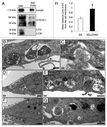 Figure 4. Caspase-dependent release of AV components during serum starvation (A) Immunoblot analysis for LAMP2, LC3-I, LC3-II and ATG16L1 in 25 ml of media conditioned by EC serum staved with vehicle DMSO (SSC) or with ZVAD-FMK 50 µM (SSC ZVAD); n = 3 for ATG16L1, LC3I and LC3-II; n = 2 for LAMP2. (B–E) Electron micrographs of EC serum starved with vehicle for 4 h showing AV near and/or interacting with the cell membrane. Scale bar: (B and C) 0.5 µm; (D) 1 µm. (E) Islet of the autophagic network in (D) located near the cell membrane; contact sites (white arrowheads). Scale bar: 0.5 μm. (F) AV in EC serum starved incubated with ZVAD-FMK 50 µM (SS + ZVAD) are located farther away from the cell membrane as opposed to AV seen in EC serum starved with vehicle (SS) (D and E). Scale bar: 1 µm. (G) Islet of the AV in (F). Scale bar: 0.5 µm. (H) Distance (µm) of AV from the cell membrane in serum-starved EC treated as in (A–G). Each AV distance was measured perpendicularly to the cell membrane in electron micrographs using ImageJ software; n = 30 cell profiles for each condition *p < 0.001 vs. SS.