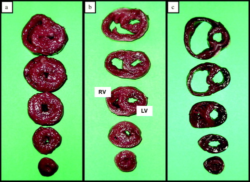 Figure 1.  Serial sections of broiler heart representing morphological changes characterized as (1a) mild ventricular dilation, (1b) moderate ventricular dilation, and (1c) severe ventricular dilation. RV, right ventricle; LV, left ventricle. It is noteworthy that as the dilation of the ventricular chambers increase, the thickness of ventricular myocardium decreases, which is indicative of degeneration of cardiac tissue.
